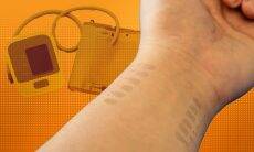 Tatuagem de grafeno pode monitorar a pressão sanguínea; saiba mais